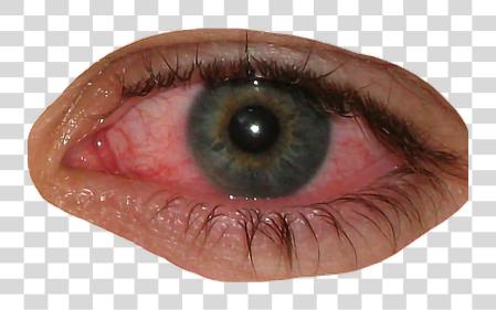 下载 eye bloodshot blood redeye bloodshoteyes facefreetoedit 粉红色 Eye PNG file