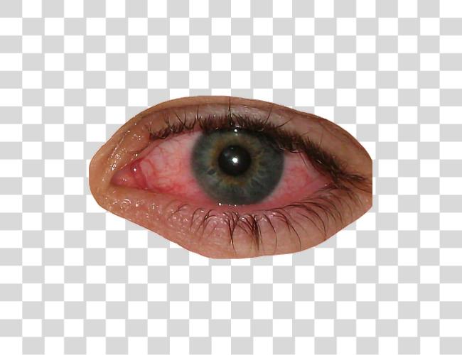 Download eye bloodshot blood redeye bloodshoteyes facefreetoedit Pink Eye Clip Art