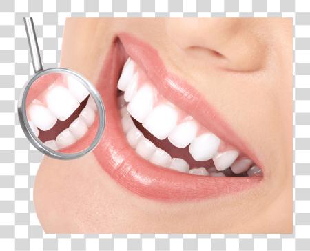 تحميل الأسنان Veneers ابتسامة الأسنان بي ان جي ملف