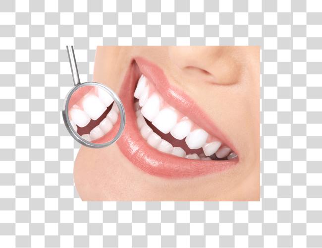 تحميل الأسنان Veneers ابتسامة الأسنان مقطوعة فن